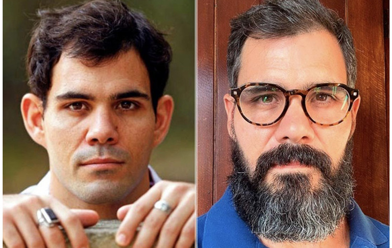 CRO-RN aplica Suspensão Cautelar em cirurgião-dentista que faz cirurgia de otoplastia (orelha)