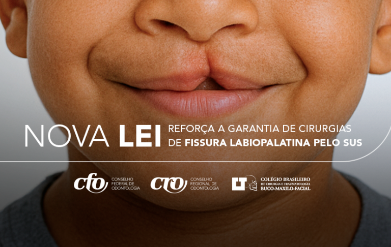 Nova lei garante oferta de cirurgia de fissura labiopalatina pelo SUS