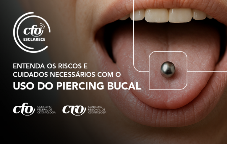 CFO Esclarece: Entenda os riscos e cuidados necessários com o uso do piercing bucal