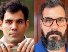 CRO-RN aplica Suspensão Cautelar em cirurgião-dentista que faz cirurgia de otoplastia (orelha)