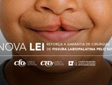 Nova lei garante oferta de cirurgia de fissura labiopalatina pelo SUS