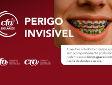 CFO Esclarece: Aparelhos ortodônticos falsos podem causar sérios riscos à saúde
