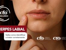 CFO Esclarece: Entenda o que é o herpes labial e o papel do cirurgião-dentista no tratamento das infecções