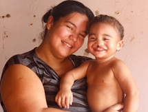 Mãe conta as dificuldades para tratar filho com fissura labiopalatal